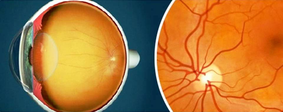 Comprehensive Ocular Examination